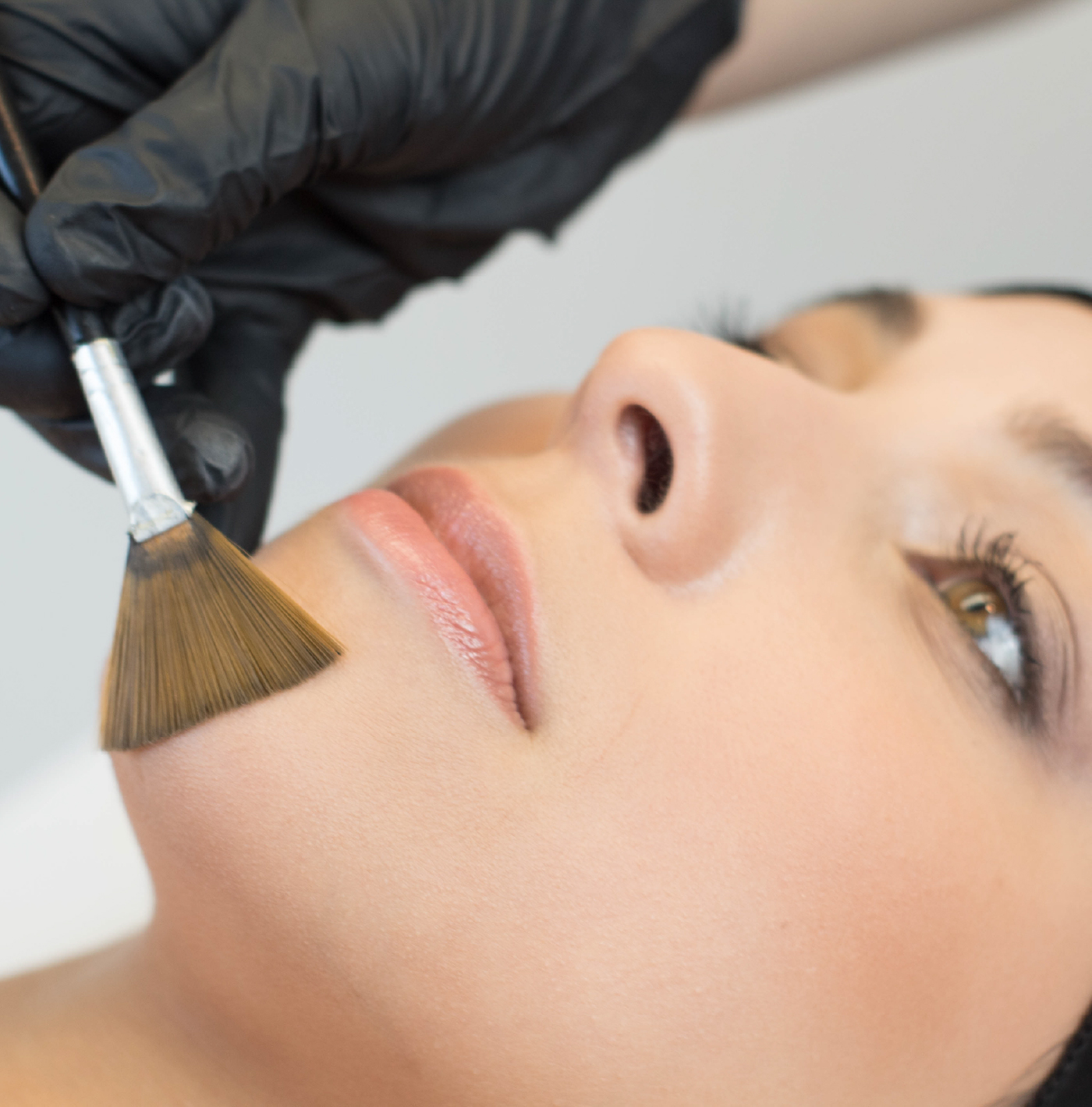 Peeling cosmetológico