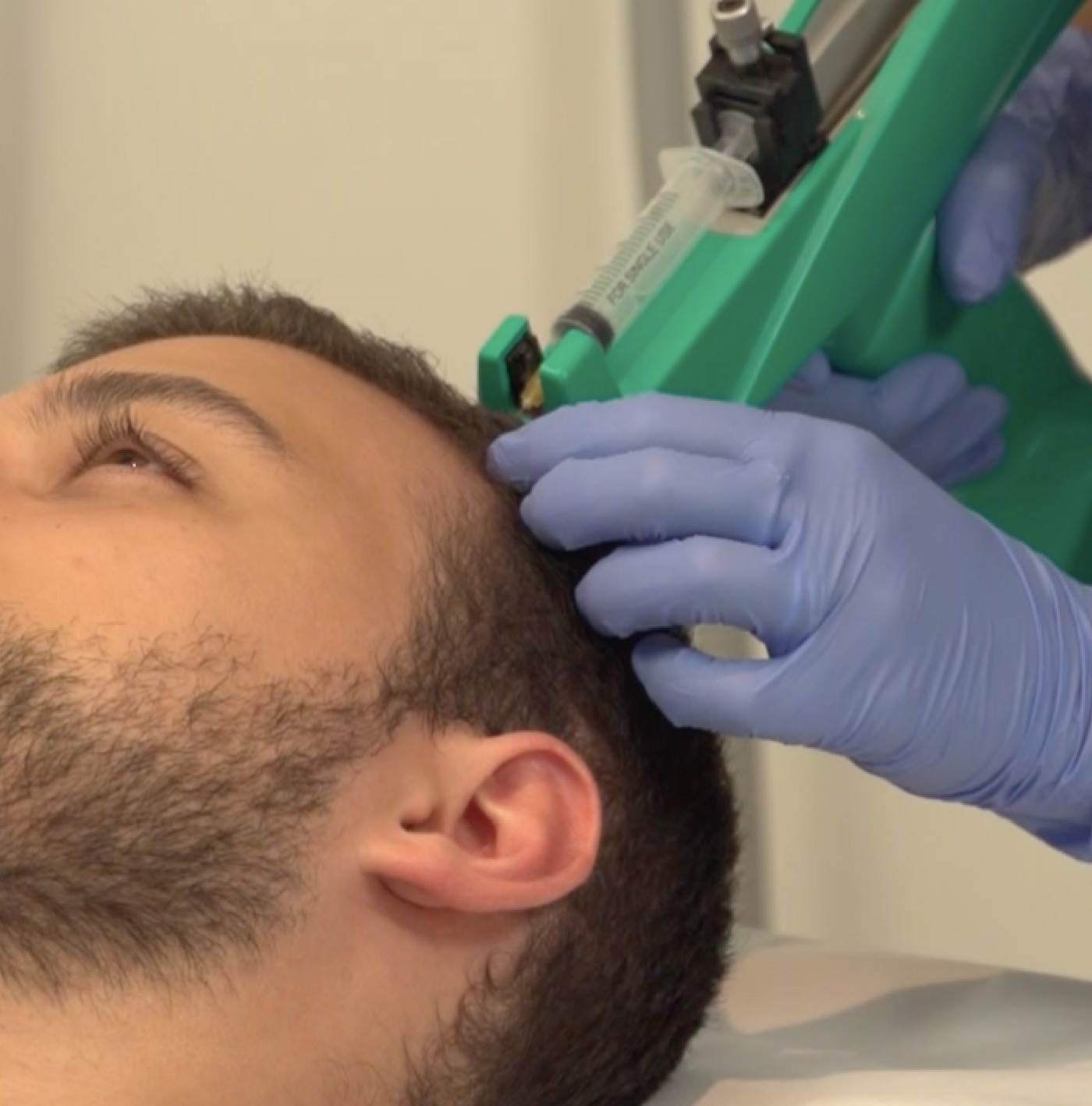 Mesoterapia