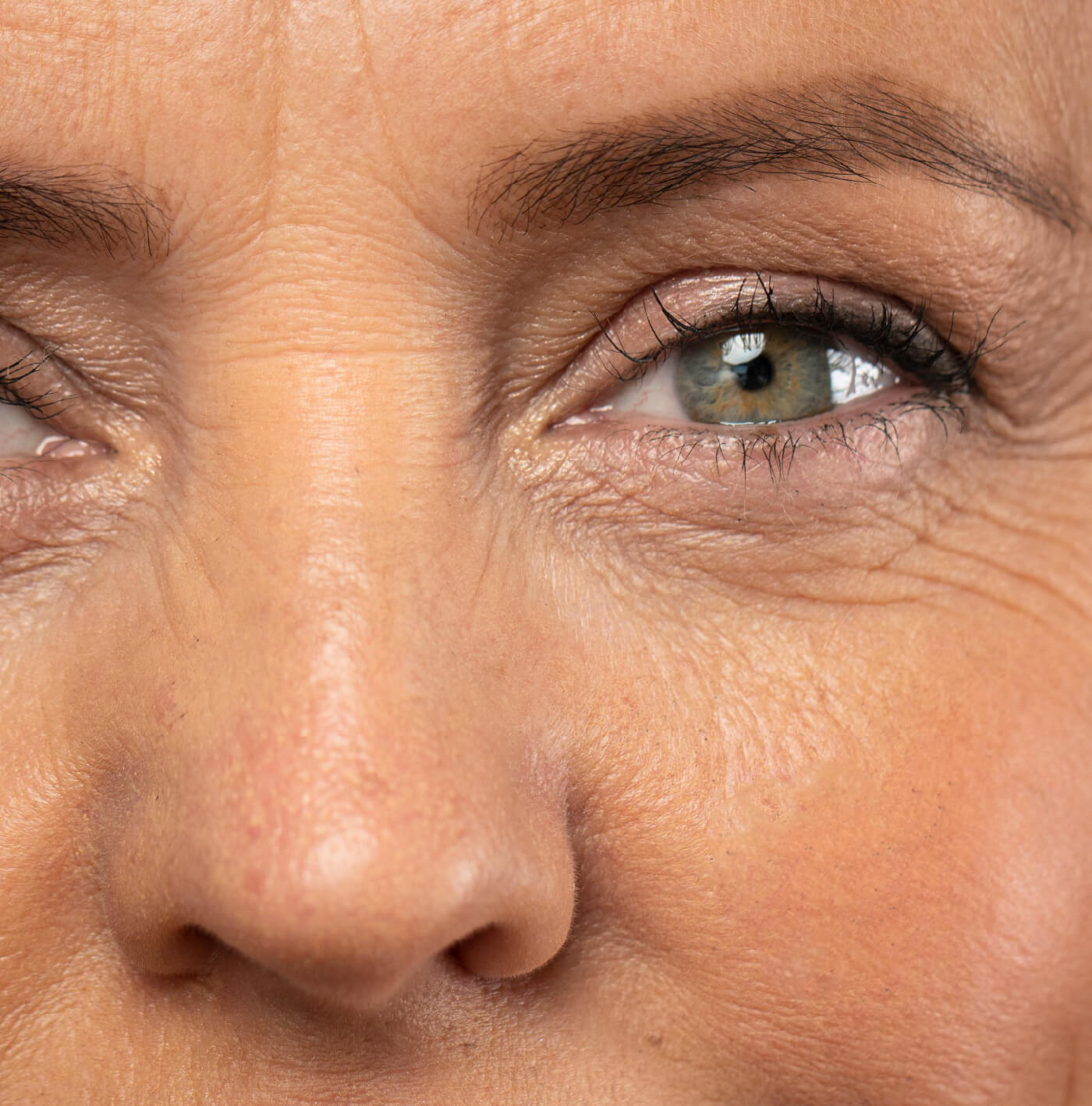 Párpados y ojeras