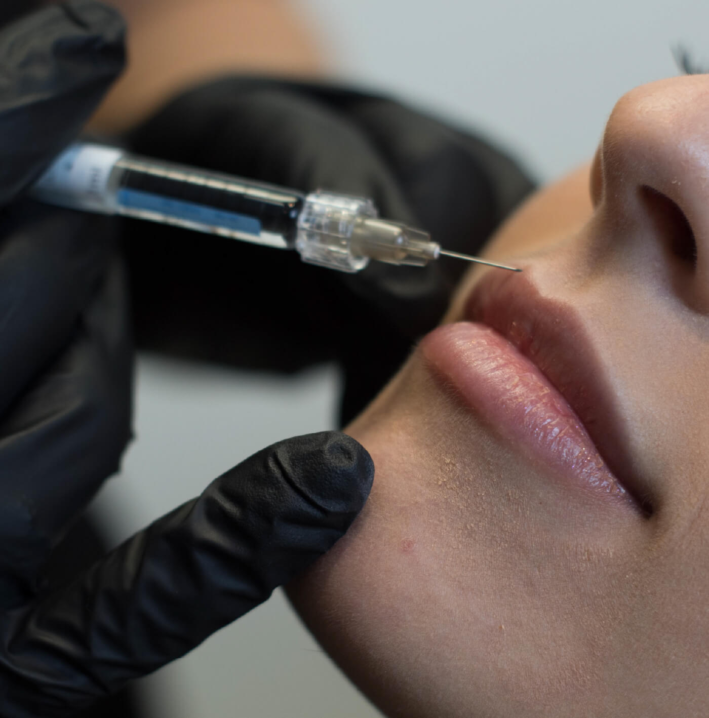 Embellecimiento de labios